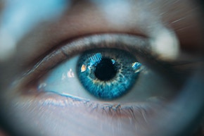 Pic of eye