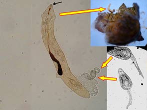 physid dygenean